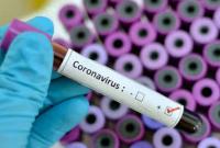 В ВСУ опровергли вспышку коронавируса среди военных медиков