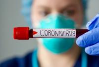 В Украине за сутки коронавирусной болезнью заболели 74 детей и 63 медика