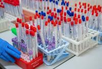 Украинцев ждет массовое ИФА-тестирование на коронавирус - Ляшко