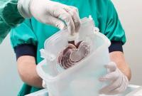 В Украине за год провели около 120 трансплантаций