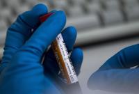 В Украине не зафиксировано ни одного подтвержденного случая коронавируса