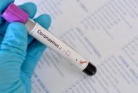 На Херсонщине зафиксировали 77 новых случаев коронавируса за сутки