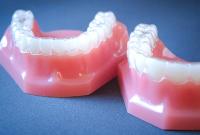 Ортодонтическое лечение: как и зачем исправляют прикус